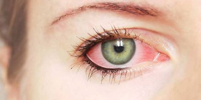Воспаление глаза, чем лечить и что делать если воспалился глаз