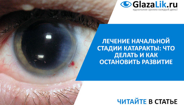 Начинающая катаракта: капли при начальной стадии катаракты, лечение