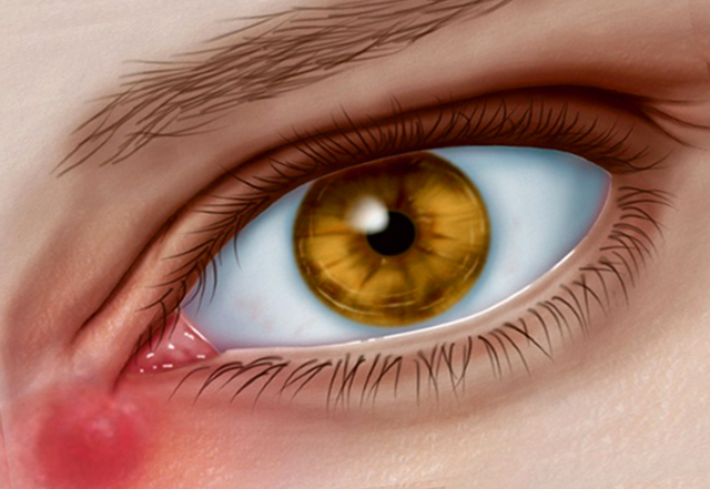 Выделения из глаза у взрослого, почему в глазах появляются белые или зеленые нитевидные выделения
