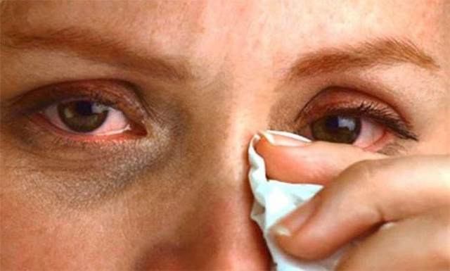 Глазное давление симптомы и лечение, норма внутриглазного давления