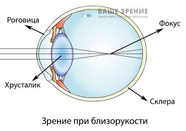 Капли для глаз для улучшения зрения, восстановление зрения глазными каплями