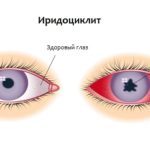 Противопоказания к лазерной коррекции зрения, особенности проведения операции на зрение