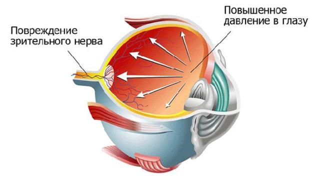 Гигиена зрения: краткие правила гигиены органов зрения