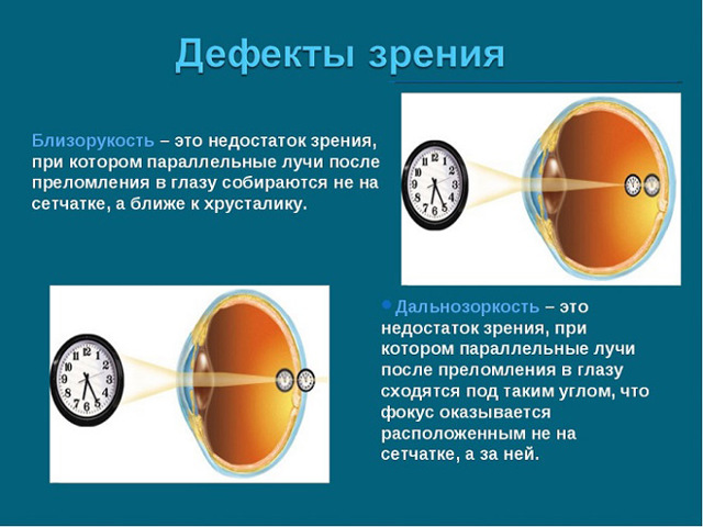 Капли для глаз для улучшения зрения при дальнозоркости