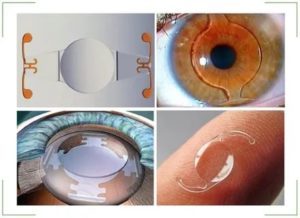 Какой лучше хрусталик ставить при катаракте во время операции