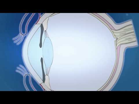 Конъюнктивальный мешок глаза: где находится конъюнктивальная полость?