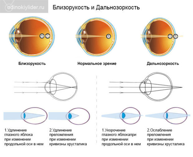 Массаж для глаз для улучшения и восстановления зрения