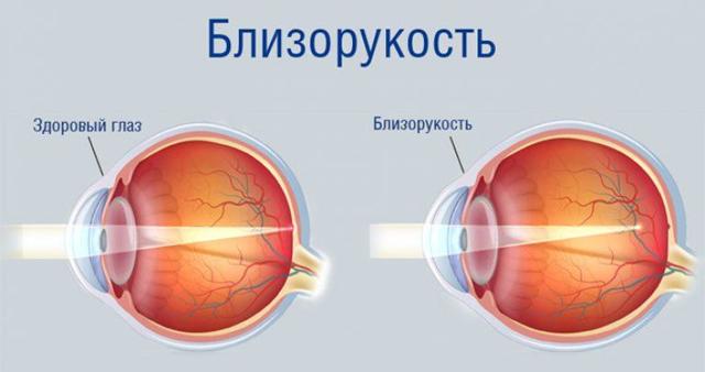 Проверка зрения у детей, таблица Орловой у окулиста для проверки глаз у ребенка от 3 лет