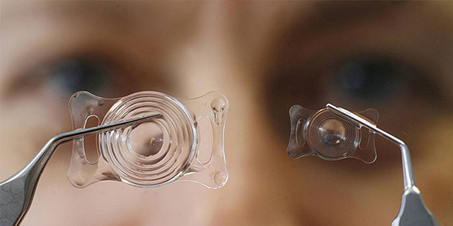 Факичные ИОЛ при катаракте - можно ли улучшить зрение