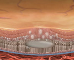 Лазерная коагуляция в лечении ЦСК - центральной серозной хорироретинопатии