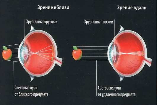После применения очков с дырочками резко ухудшилось зрение