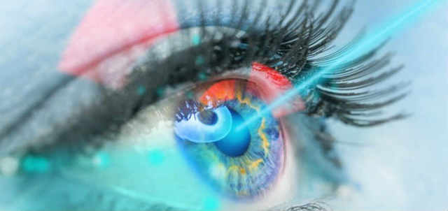 Рефракционная хирургия глаза