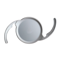 EDOF-ИОЛ Tecnis Simfony - стоимость установки на оба глаза