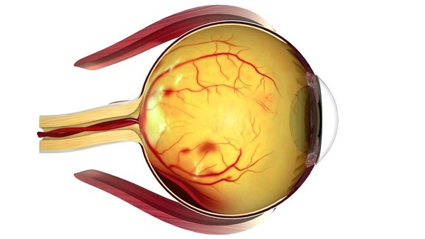 Ретинопатии сетчатки глаза