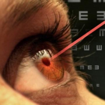 Противопоказания к лазерному лечению мушек перед глазами
