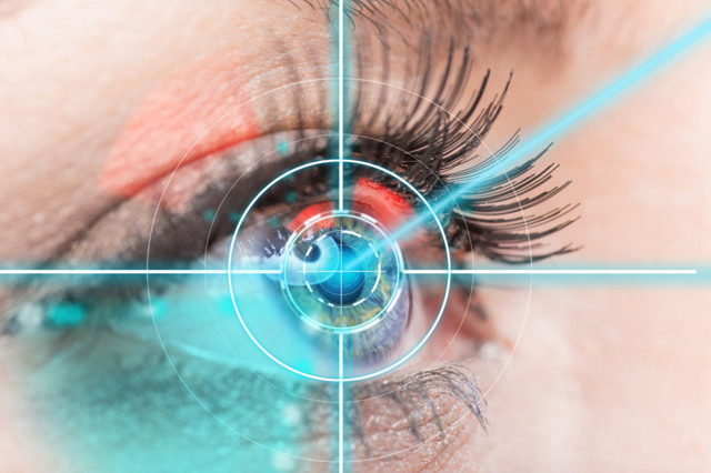 17 лет - можно ли делать лазерную коррекцию зрения