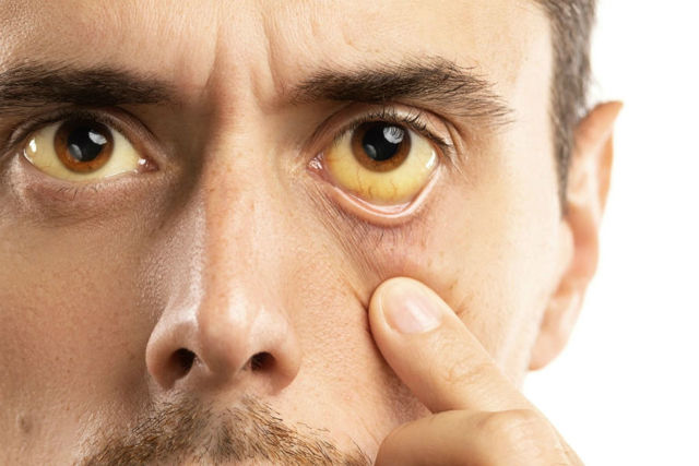 Диагностика заболеваний глаз