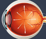 Офтальмогипертензия, катаракта и болезни сетчатки - где лечат