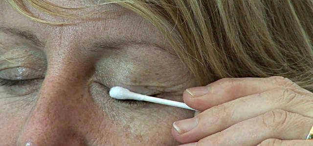 Блефароконъюнктивит глаз: причины, симптомы и эффективные методы лечения заболевания