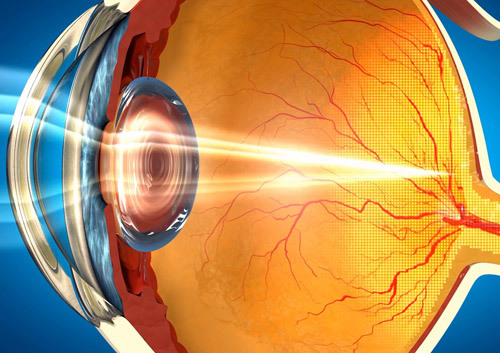 Эрозия роговицы глаза: травматическая, рецидивирующая и т.д. Причины и лечение, негативные последствия