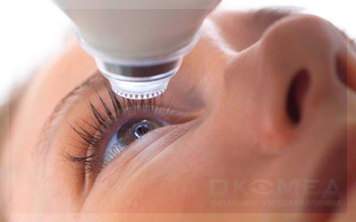Интракапсулярная экстракция катаракты (ИЭК) - операция по замене хрусталика при катаракте