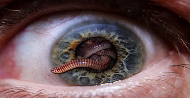 Офтальмомиазы - паразиты в глазах человека: причины, симптомы и лечение