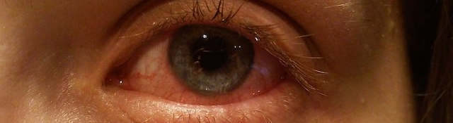Падает зрение при глаукоме - что делать, где лечить?