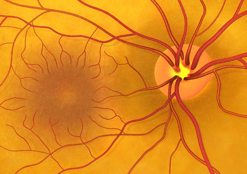 Реваскуляризация заднего отдела глаза при атрофии зрительного нерва, дистрофии сетчатки