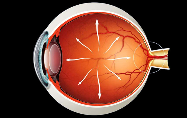 Болит глаз при глаукоме - что делать?