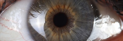 Эрозия роговицы глаза: травматическая, рецидивирующая и т.д. Причины и лечение, негативные последствия