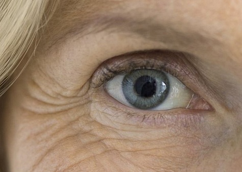 Открытоугольная глаукома - как поддержать зрение