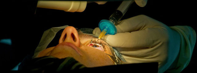Как проходят операции на глазах - боль, наркоз и реабилитация