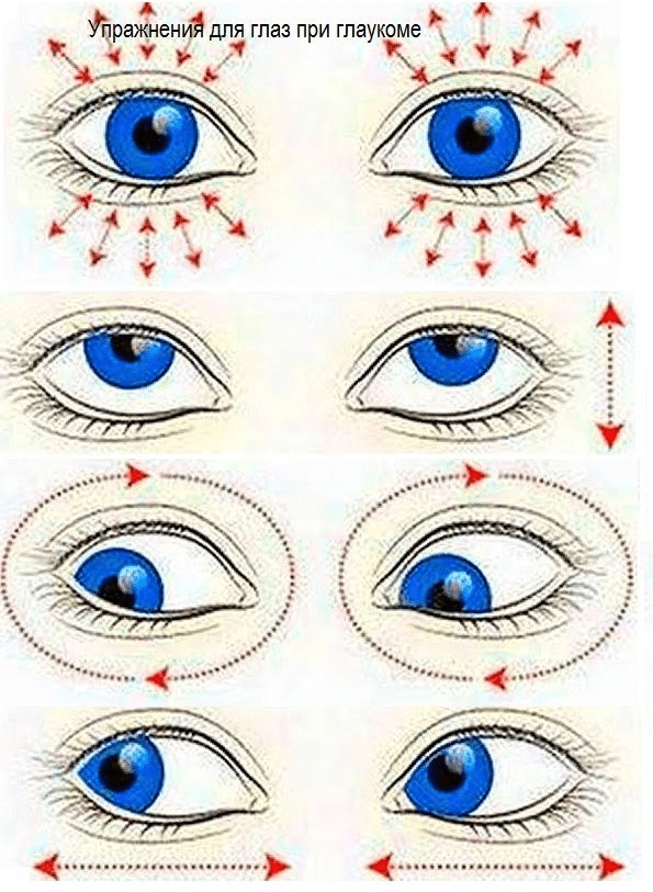 Открытоугольная глаукома - как поддержать зрение
