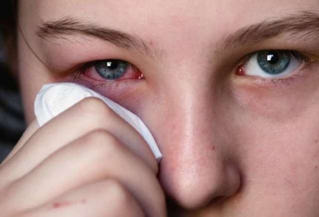 Первая помощь при травмах глаза: доврачебная и медицинская