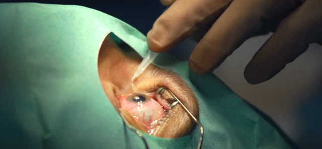 Как проходят операции на глазах - боль, наркоз и реабилитация