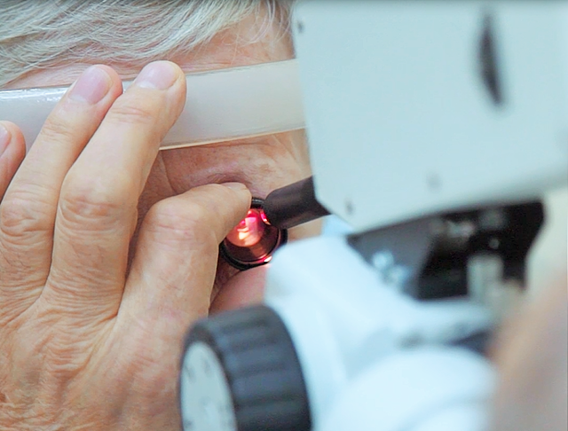 Помутнение задней капсулы хрусталика глаза: причины и лечение (лазерная дисцизия)