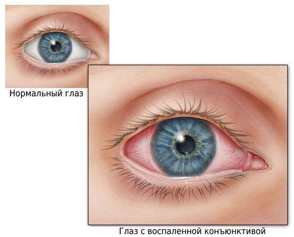 Галазомир прибор для восстановления зрения - описание, показания к применению и отзывы