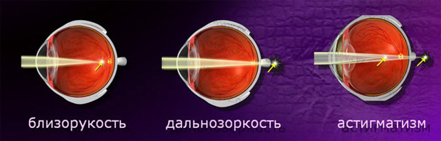 Трактовка результатов обследования глаз у офтальмолога