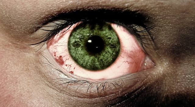 Хроническое покраснение глаз в течение многих лет