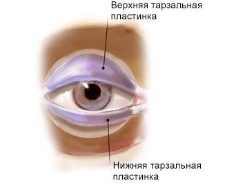 Можно ли вылечить внутренний ячмень на глазу без операции?