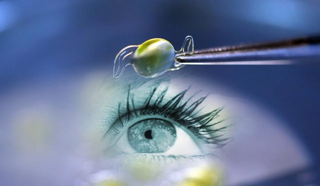 Коррекция зрения у взрослого при врожденной катаракте