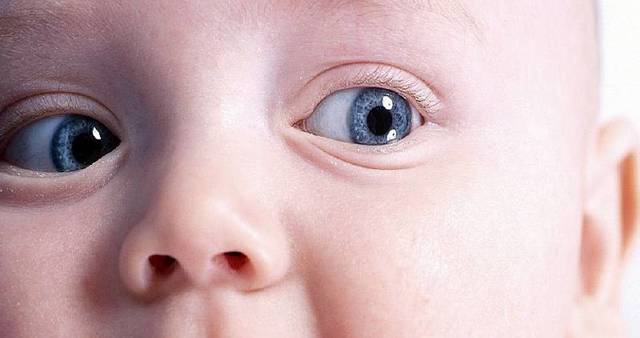 Врожденная катаракта и лазерная коррекция зрения